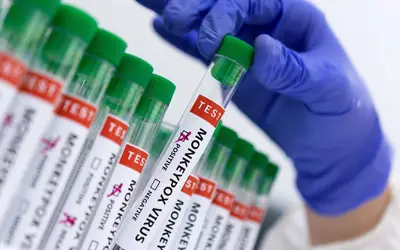 Secretaria da Saúde confirma segundo caso de varíola dos macacos em Curitiba