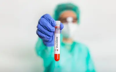 Anvisa analisa cinco pedidos de testes para diagnóstico de varíola dos macacos