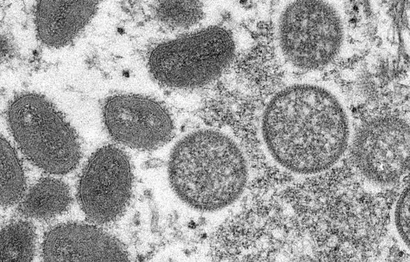 Roche diz que agiliza processo para trazer teste de varíola dos macacos ao Brasil
